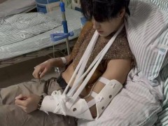 被游客掰断手腕的景区NPC再发声 治疗费用成难题