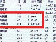 40岁卖货博主每天两三点睡肝功能异常 医生提醒